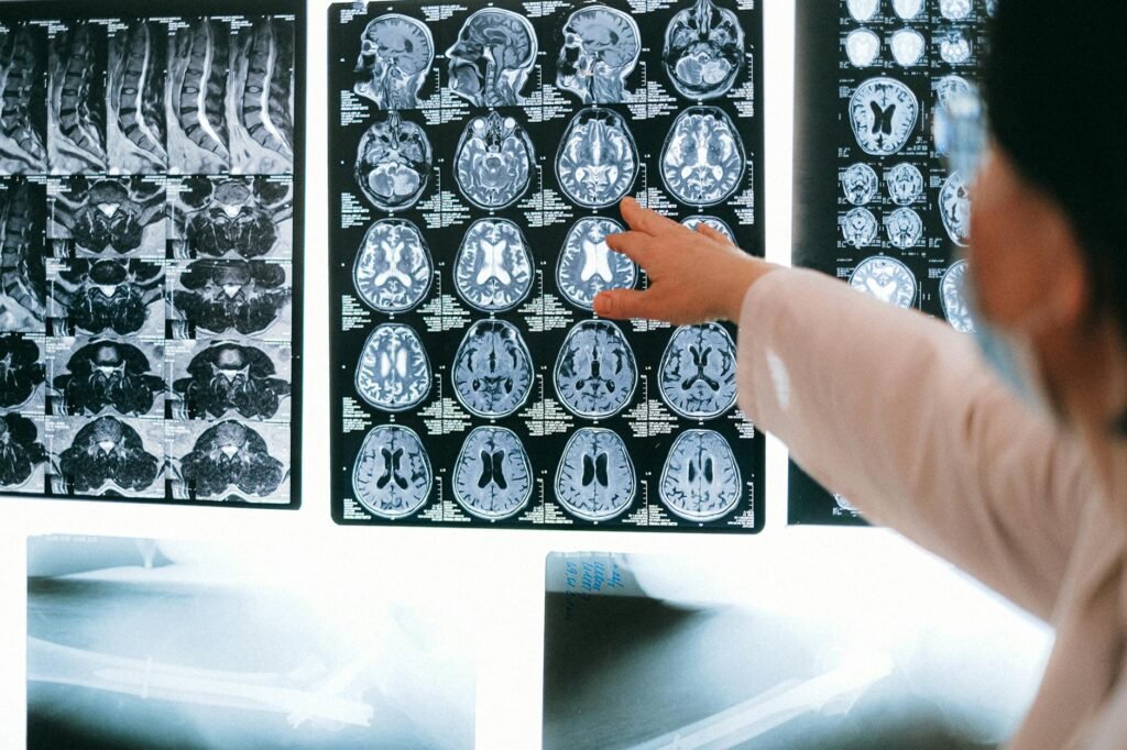 close up shot of mri results