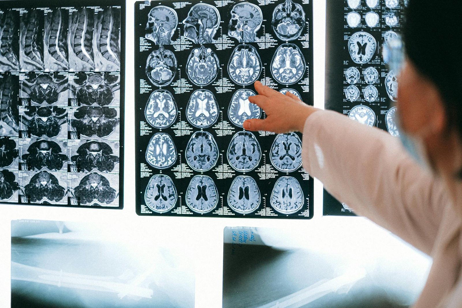 What Science Says About Magnesium and Sleep? 1 close up shot of mri results